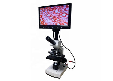 Analisi del globulo del microscopio dell'affissione a cristalli liquidi Digital del microscopio biologico del laboratorio di WF10X 2000X