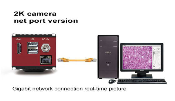 Macchina fotografica digitale del microscopio di HDMI 60FPS con l'interfaccia di rete di gigabit